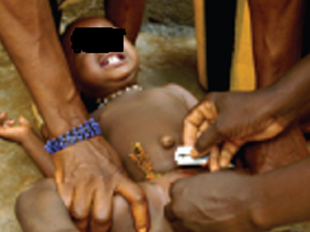 RÃ©sultat de recherche d'images pour "lutte contre la pratique de l'excision au burkina faso"